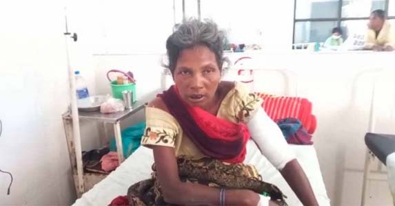 पति को बचाने भालुओं से भिड़ गई पत्नी, खुद बुरी तरह से घायल हुई