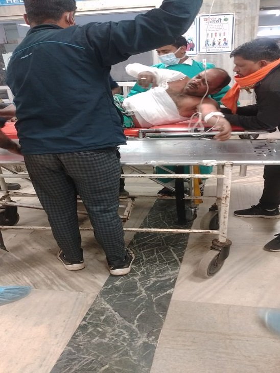 भिलाई स्टील प्लांट में विस्फोट: स्लैग में गर्म पानी डालते समय 6 मजदूर झुलसे